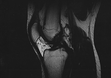 MRT (MRI) Scan - Radiologie, MRT und Nuklearmedizinische Diagnostik in ...